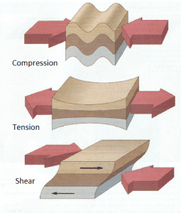 Image of a spinal cord