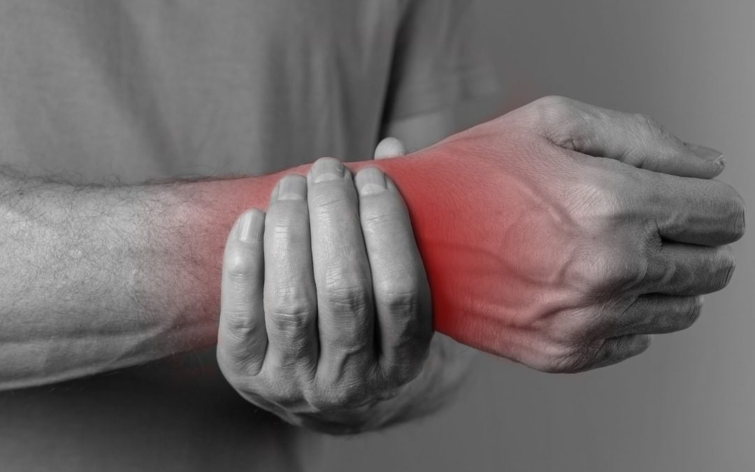 How to Manage a Colles Fracture